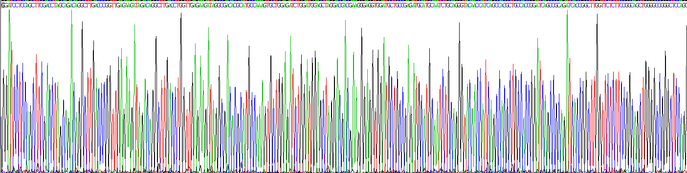 Recombinant Superoxide Dismutase 3, Extracellular (SOD3)