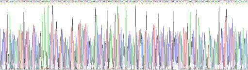 Recombinant Transforming Growth Factor Beta 1 (TGFb1)