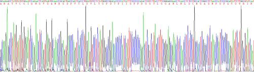 Recombinant Carcinoembryonic Antigen (CEA)