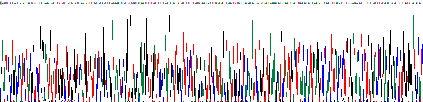 Recombinant Paraoxonase 1 (PON1)