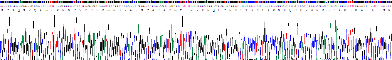 Recombinant Insulin Like Growth Factor Binding Protein 6 (IGFBP6)