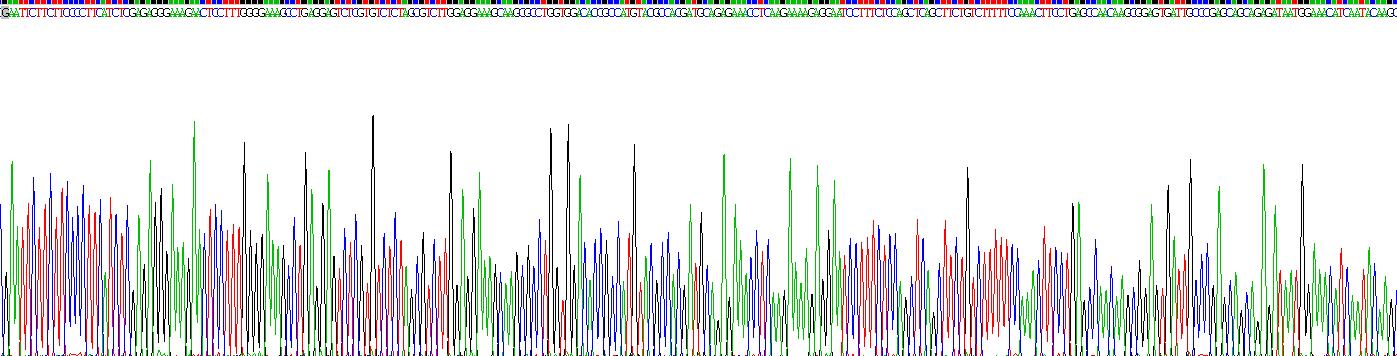 Recombinant Thyroid Peroxidase (TPO)