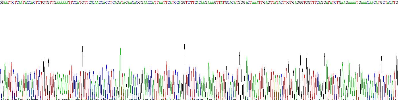 Recombinant Complement Factor H (CFH)