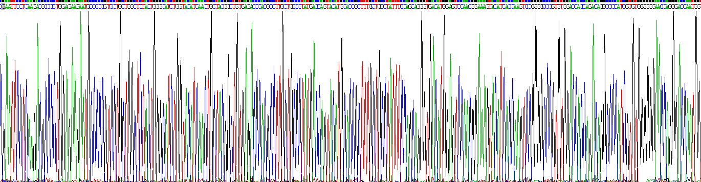 Recombinant Glucose 6 Phosphate Isomerase (GPI)