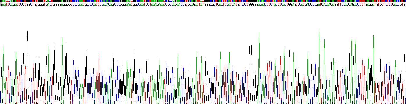 Recombinant Acid Phosphatase 5, Tartrate Resistant (ACP5)