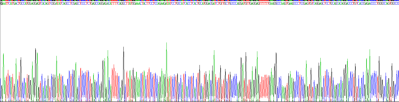 Recombinant Tumor Protein p53 (P53)