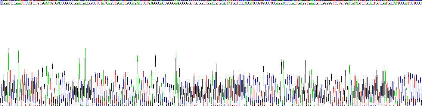 Recombinant Nephrin (NPHN)