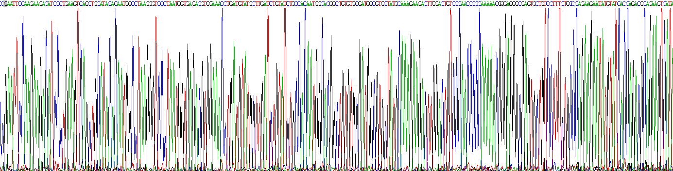 Recombinant Procollagen I N-Terminal Propeptide (PINP)