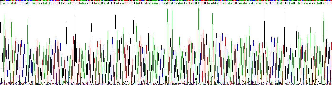 Recombinant Pyruvate Dehydrogenase Kinase 4 (PDK4)