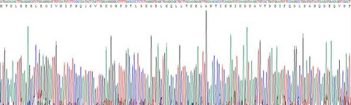 Recombinant S100 Calcium Binding Protein A12 (S100A12)