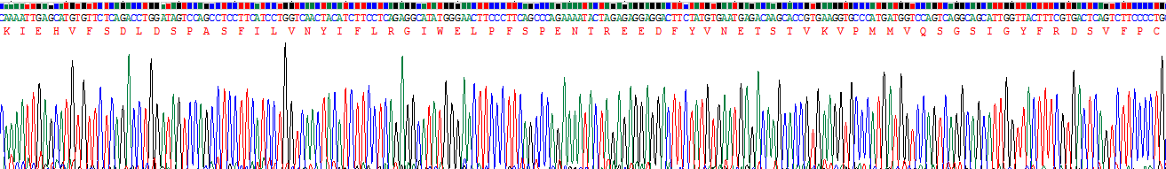 Recombinant Corticosteroid Binding Globulin (CBG)