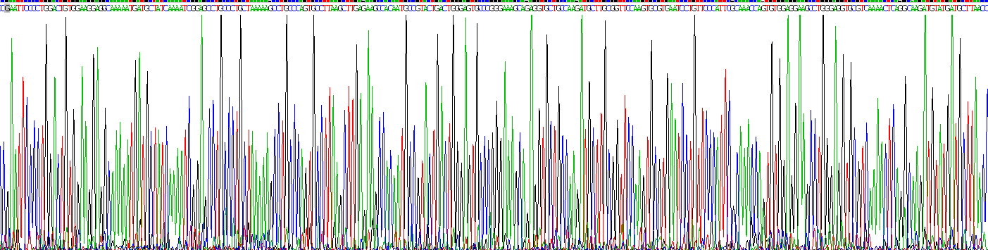 Recombinant Secretory Leukocyte Peptidase Inhibitor (SLPI)