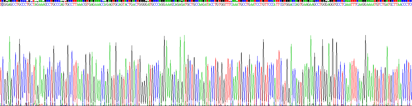 Recombinant Secretory Leukocyte Peptidase Inhibitor (SLPI)