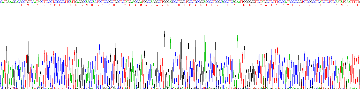 Recombinant Acid Sphingomyelinase (ASM)