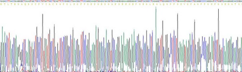 Recombinant Mannose Binding Lectin (MBL)