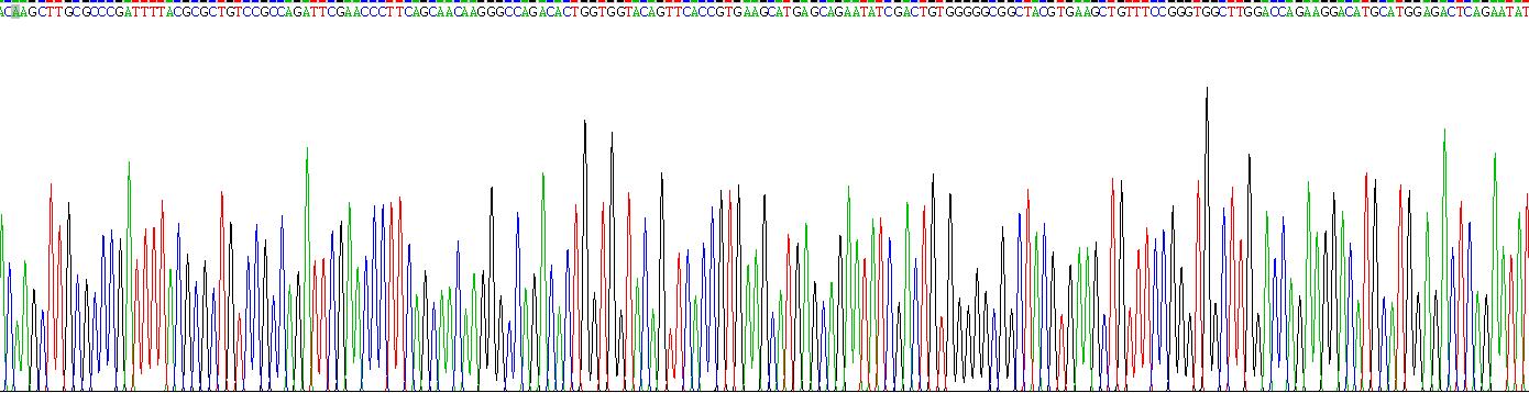 Recombinant Calreticulin (CALR)