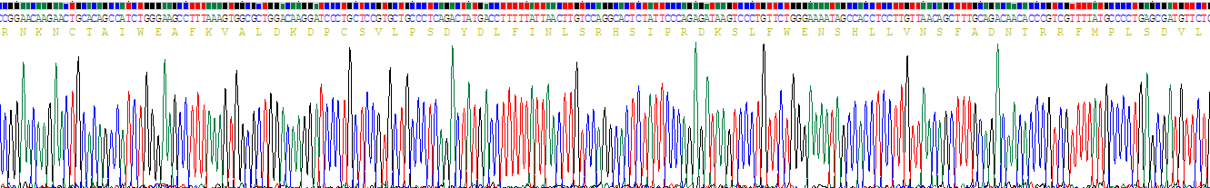 Recombinant Bone Marrow Stromal Cell Antigen 1 (BST1)