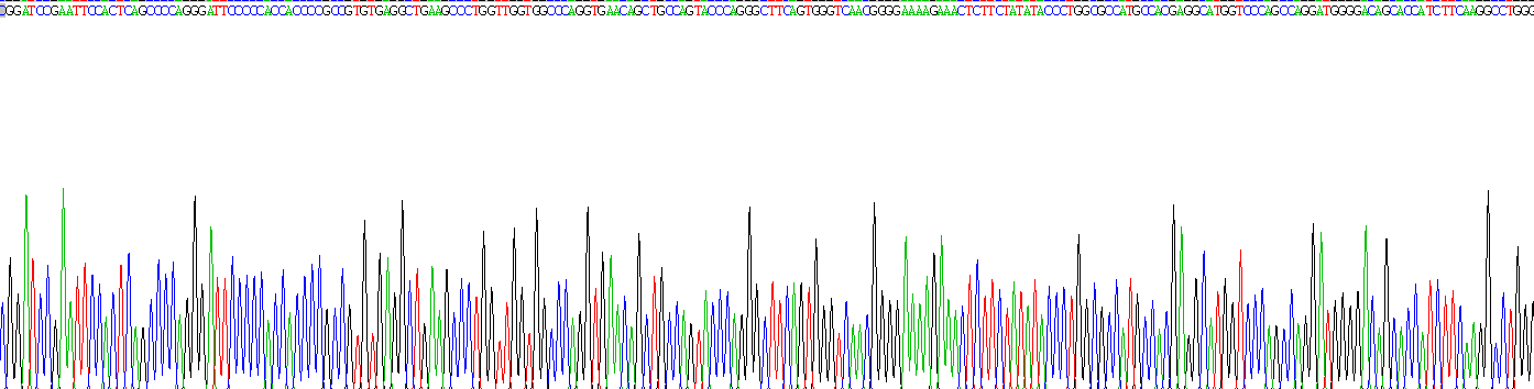 Recombinant Interferon Regulatory Factor 5 (IRF5)