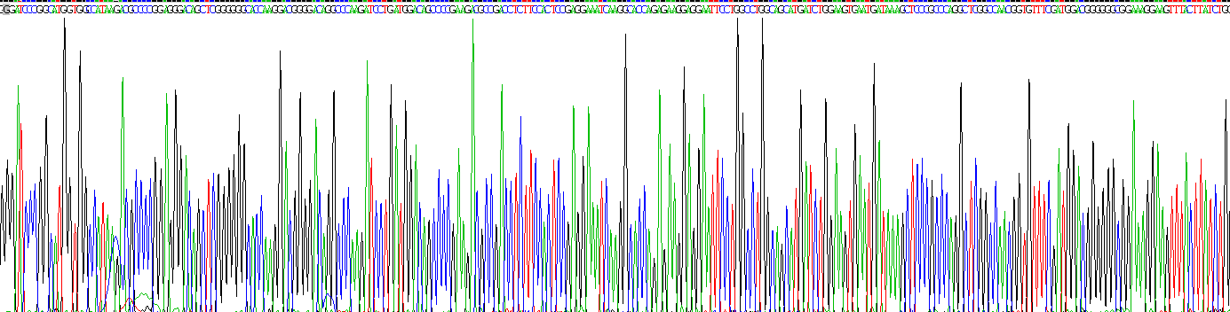 Recombinant Protein Kinase, AMP Activated Beta 1 (PRKAb1)