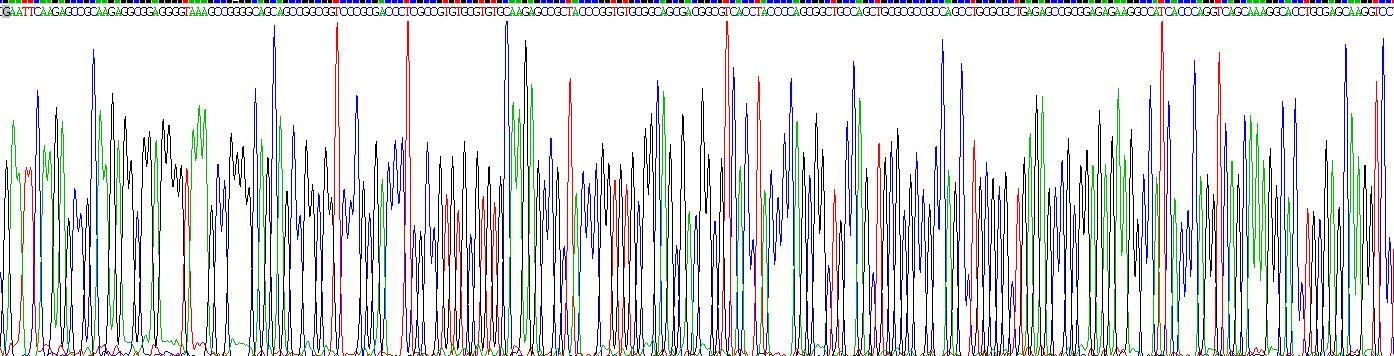 Recombinant Insulin Like Growth Factor Binding Protein 7 (IGFBP7)