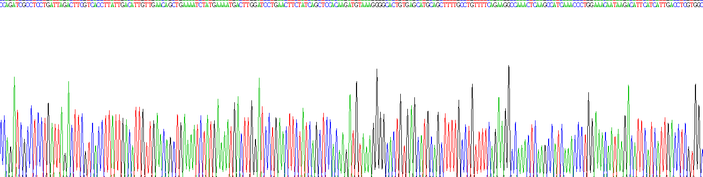 Recombinant Interleukin 21 (IL21)