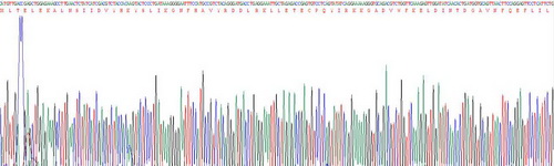 Recombinant S100 Calcium Binding Protein A8 (S100A8)