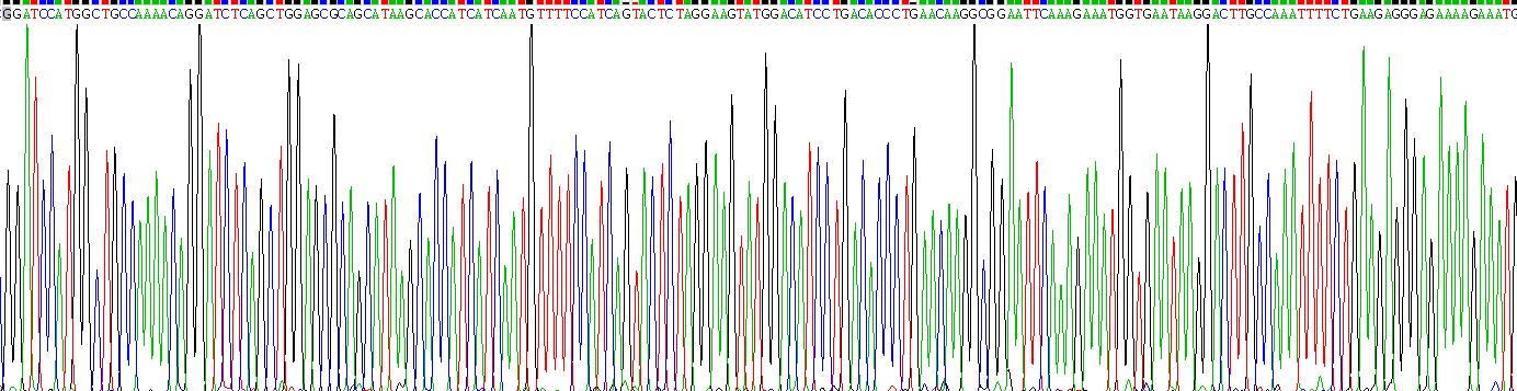 Recombinant S100 Calcium Binding Protein A9 (S100A9)