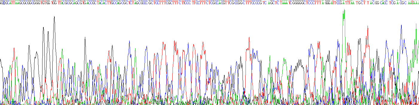 Recombinant Vitamin D Binding Protein (DBP)