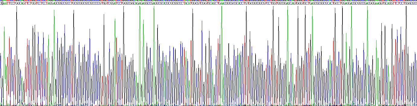 Recombinant Complement Factor D (CFD)