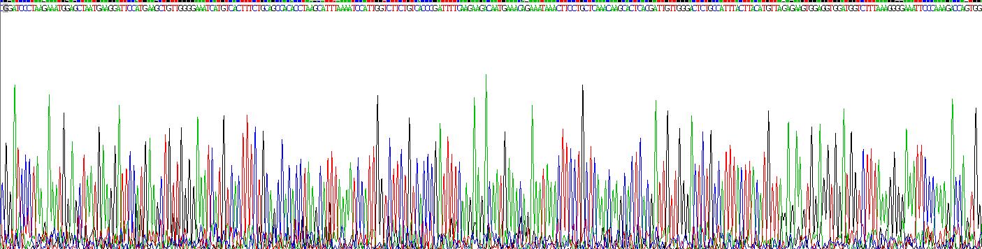 Recombinant Angiotensin I Converting Enzyme 2 (ACE2)