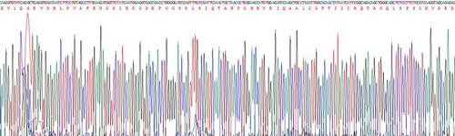 Recombinant Hemojuvelin (HJV)