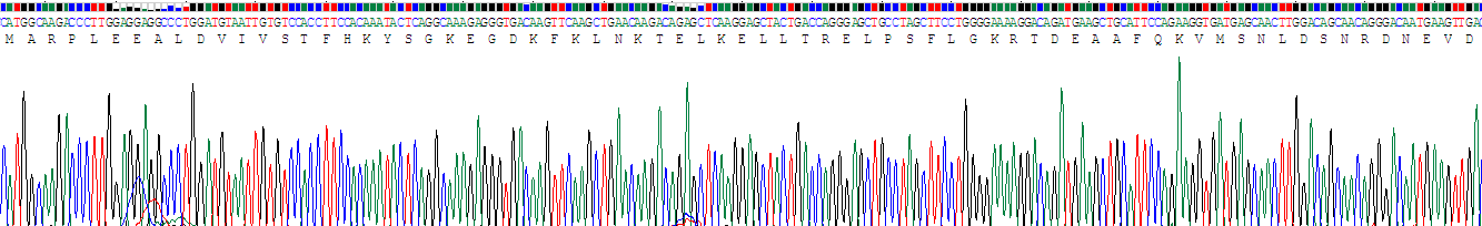 Recombinant S100 Calcium Binding Protein A4 (S100A4)