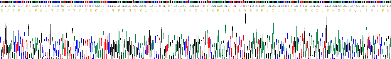 Recombinant S100 Calcium Binding Protein A5 (S100A5)