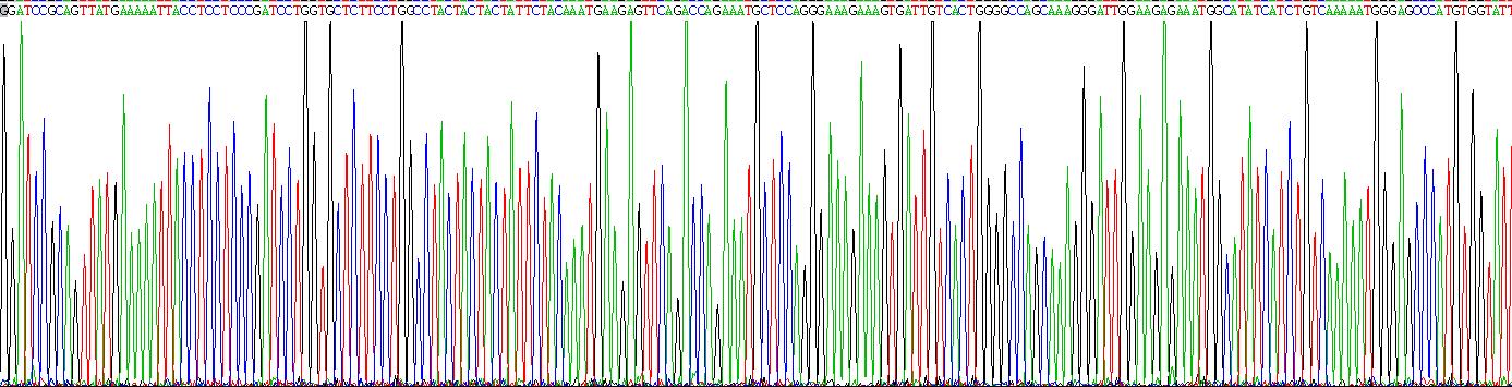 Recombinant 11-Beta-Hydroxysteroid Dehydrogenase Type 1 (HSD11b1)