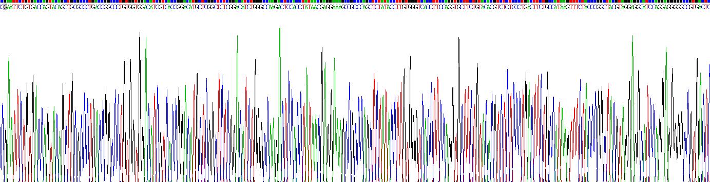 Recombinant 7-Dehydrocholesterol Reductase (DHCR7)