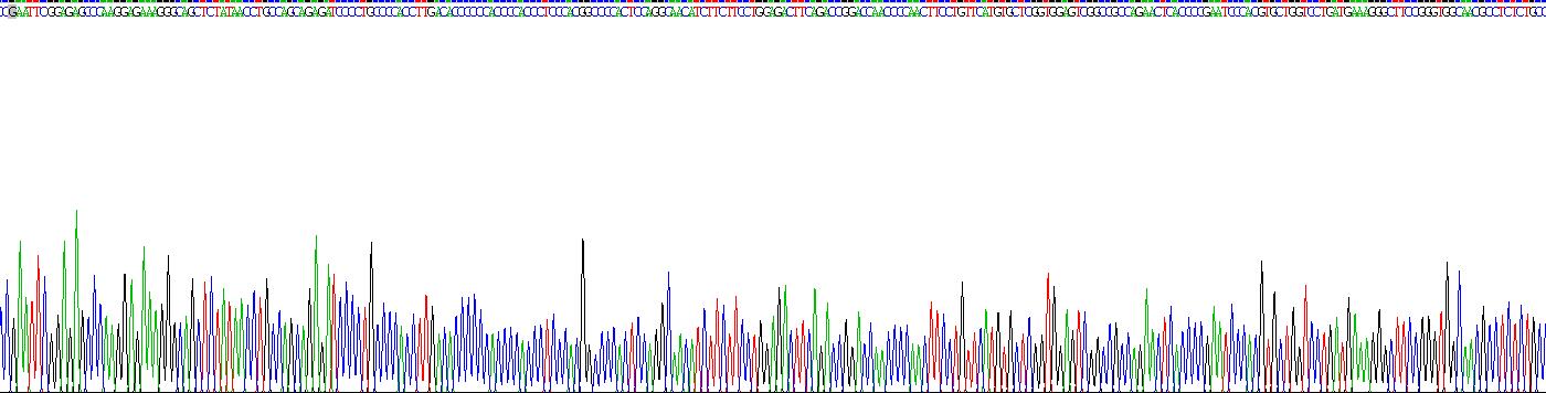 Recombinant Alpha-1,4-Galactosyltransferase (a4GALT)