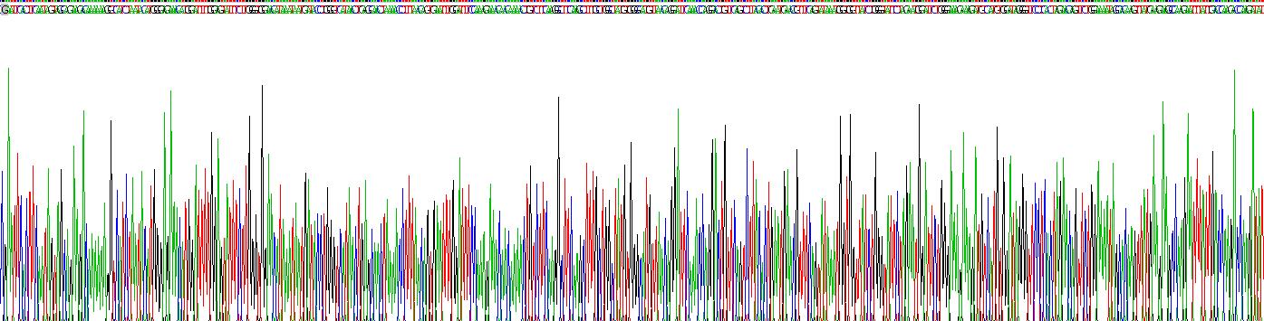 Recombinant N-Acylsphingosine Amidohydrolase 1 (ASAH1)