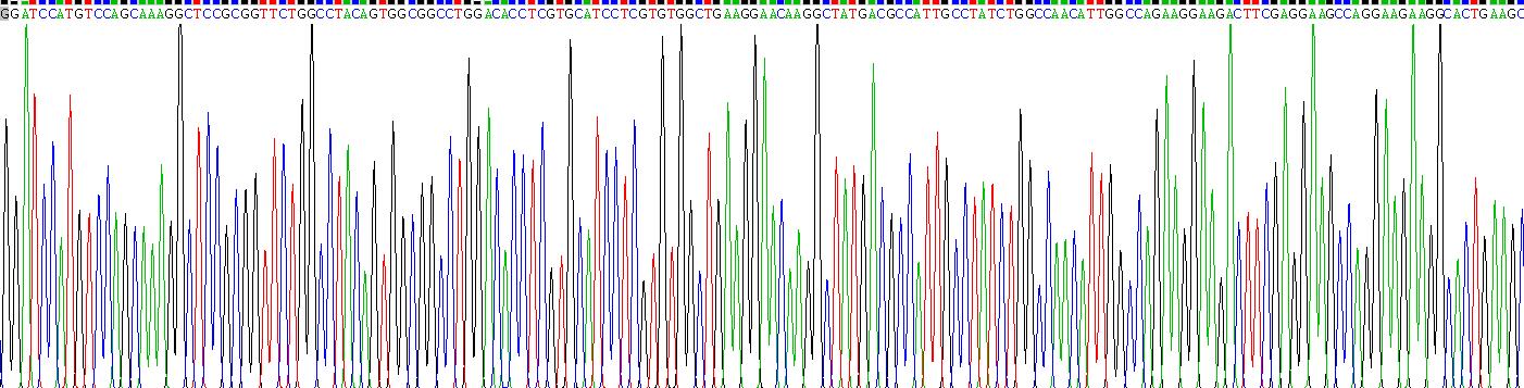 Recombinant Argininosuccinate Synthetase 1 (ASS1)