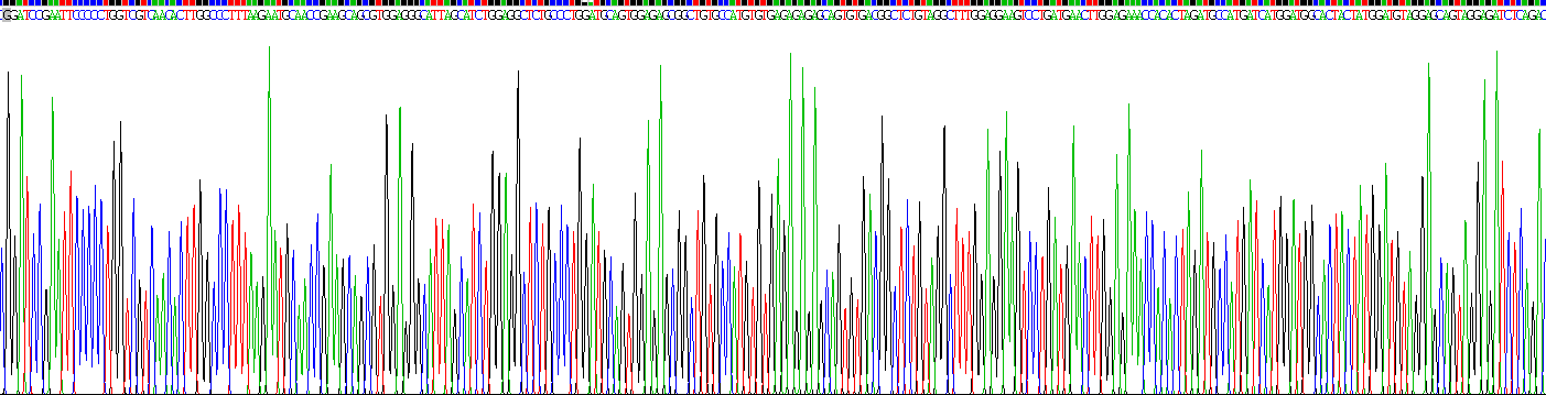 Recombinant Aspartylglucosaminidase (AGA)