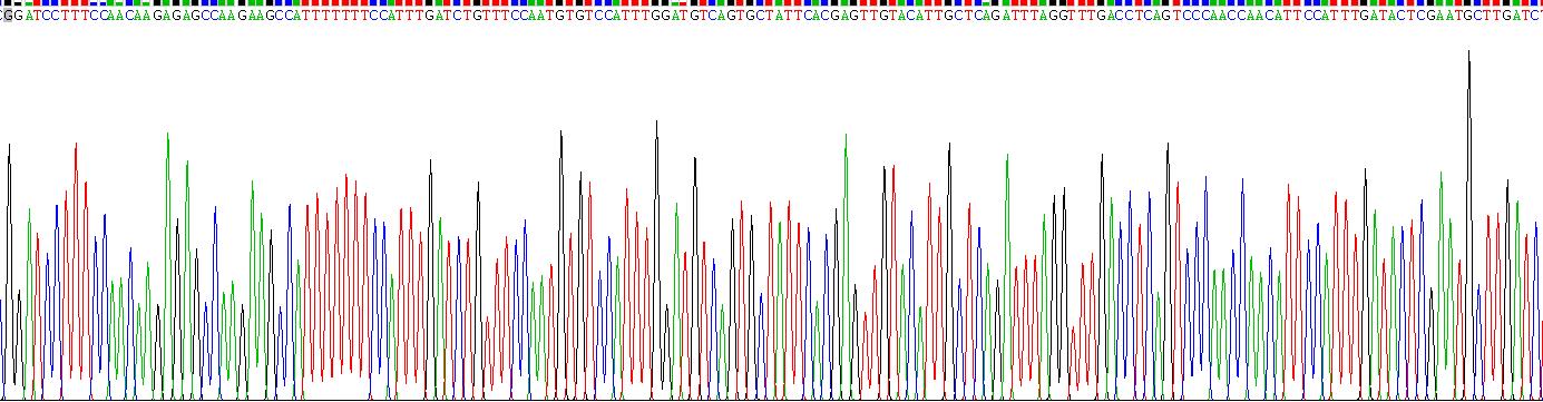 Recombinant Asporin (ASPN)