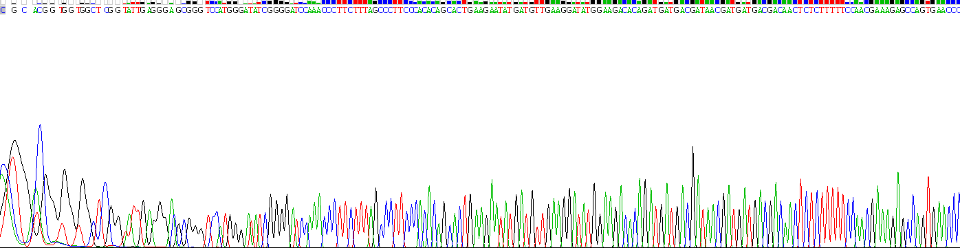 Recombinant Asporin (ASPN)