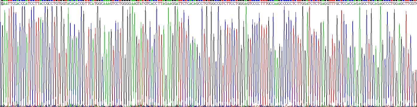 Recombinant Carboxylesterase 1 (CES1)