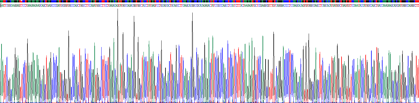 Recombinant Carnitine Palmitoyltransferase 2, Mitochondrial (CPT2)