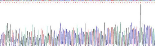 Recombinant Extracellular Matrix Protein 1 (ECM1)