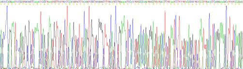 Recombinant Stanniocalcin 1 (STC1)