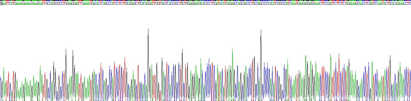 Recombinant Supervillin (SVIL)