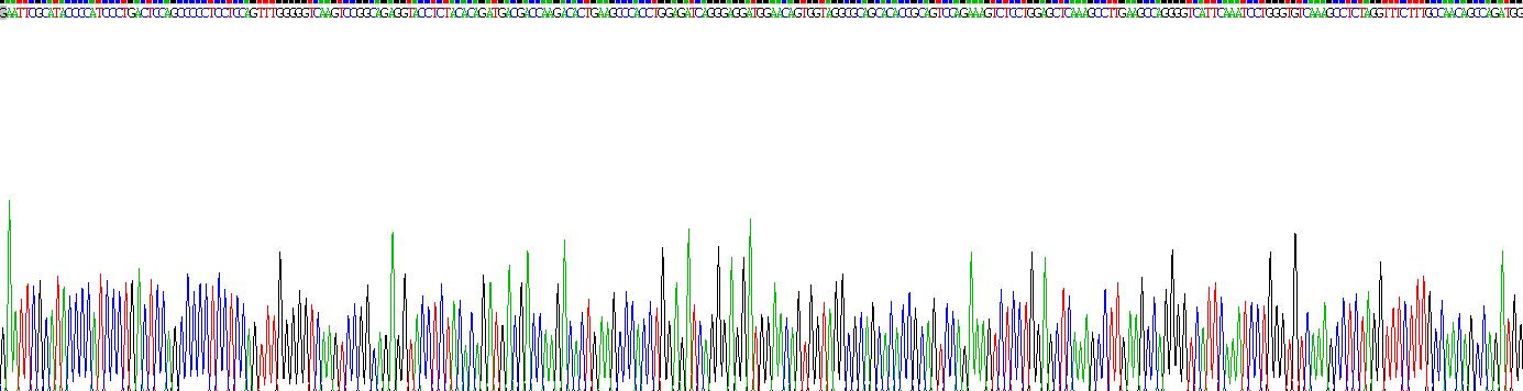 Recombinant Fibroblast Growth Factor 21 (FGF21)