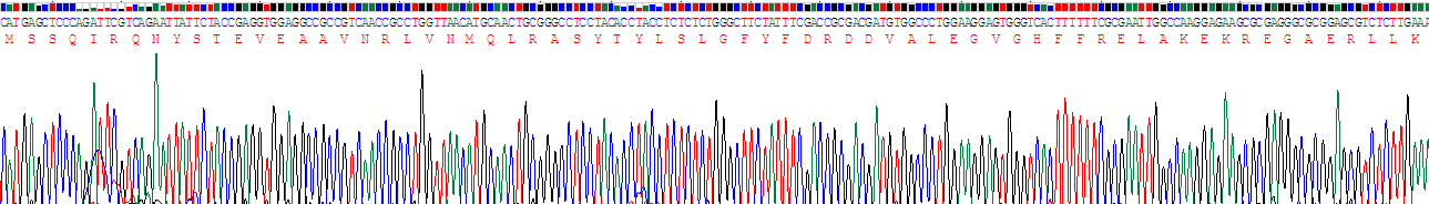 Recombinant Ferritin, Light Polypeptide (FTL)