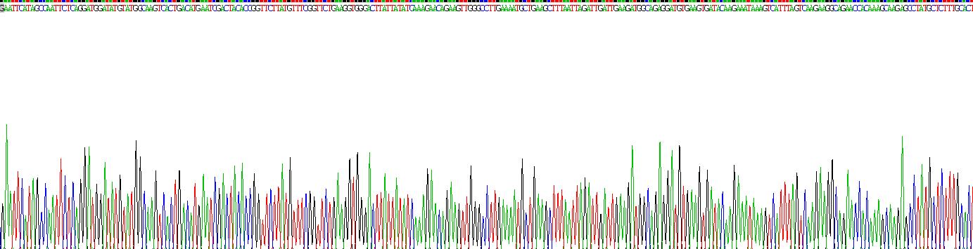 Recombinant Sjogren Syndrome Antigen A2 (SSA2)