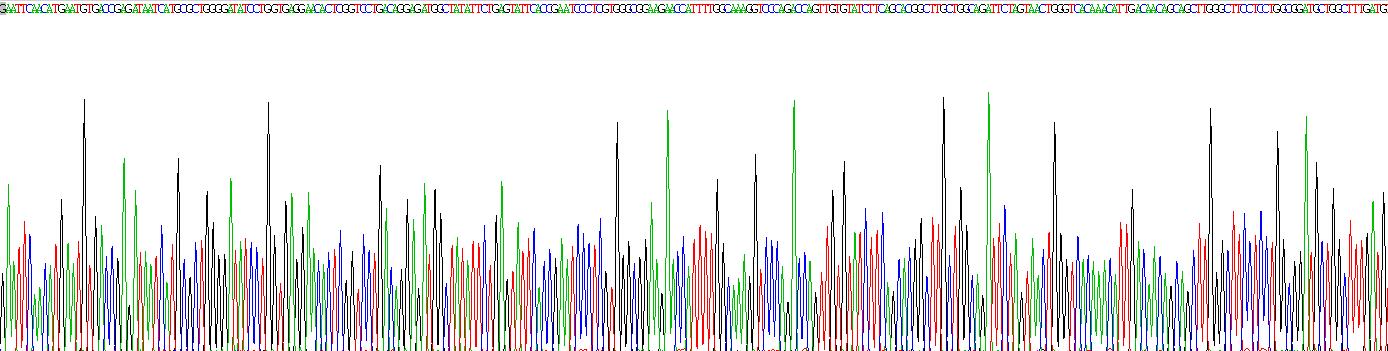 Recombinant Lipase A, Lysosomal Acid (LIPA)